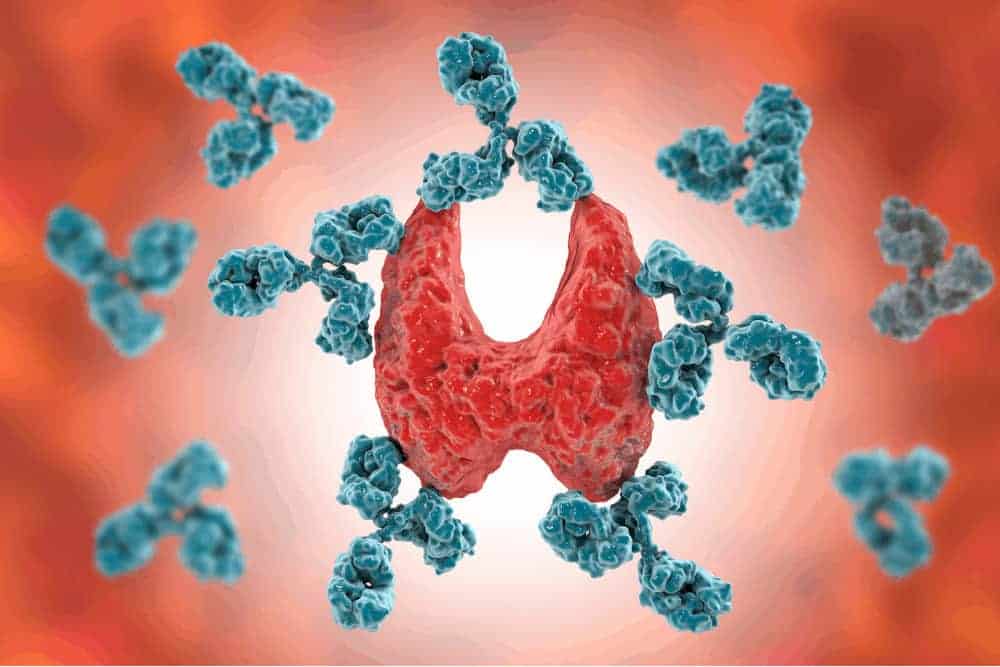 Schilddrüse Antikörper Hashimoto
